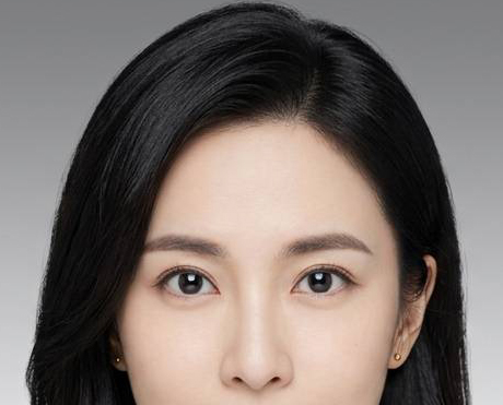 韓式釘書針雙眼皮