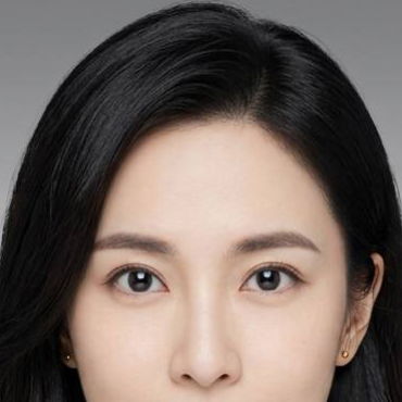 韓式釘書針雙眼皮