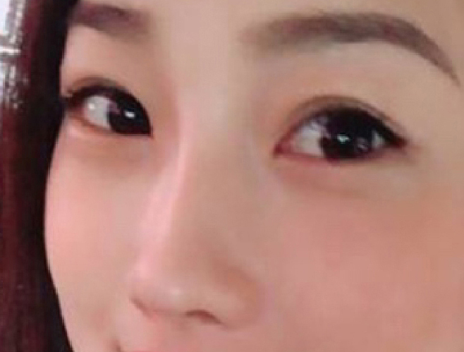 晶亮瓷